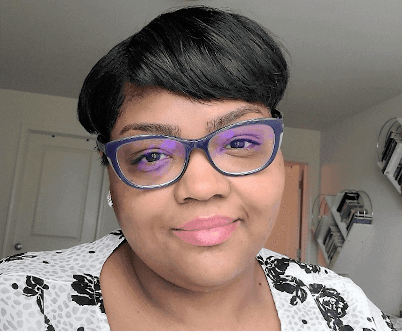 An interview with Tono patient Jovette Simmons